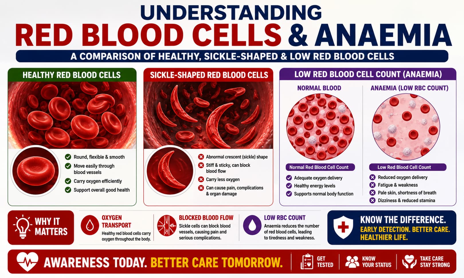 A medical illustration comparing healthy red blood cells with abnormal sickle-shaped red blood cells and low red blood cell counts associated with anaemia.